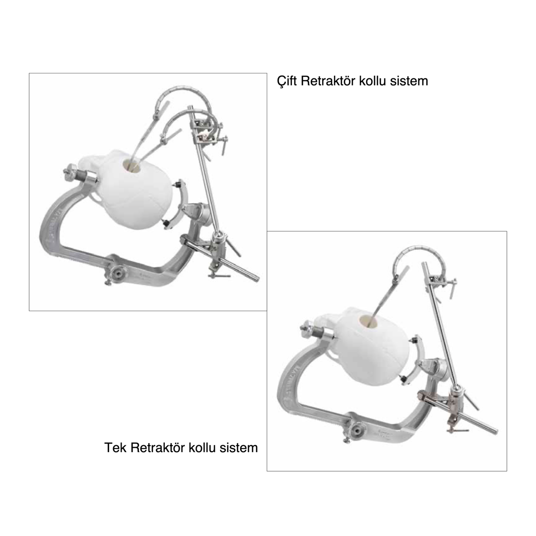 Mayfield Minimal Retraksiyon Sistemi (MRS)