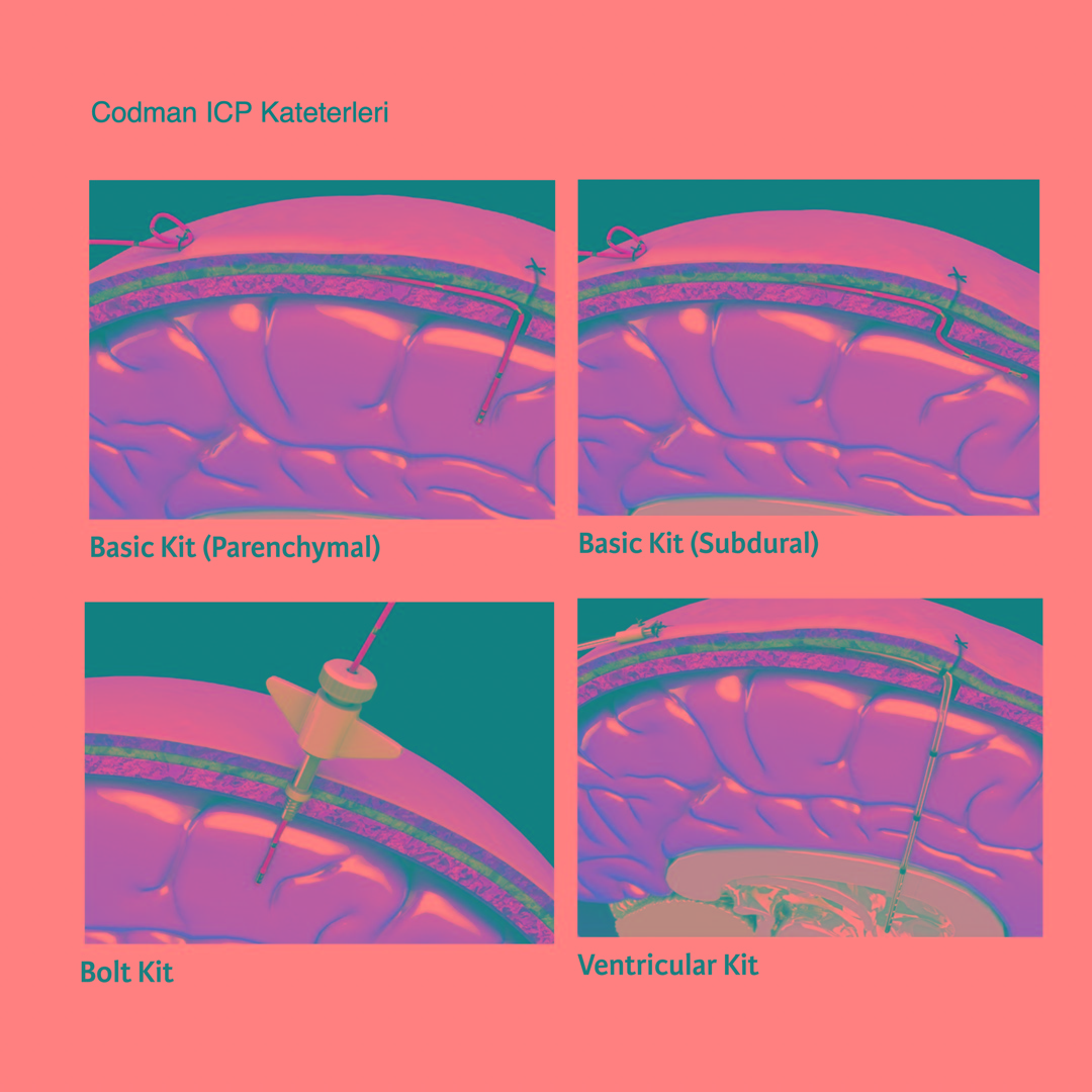 Codman ICP Kateterleri