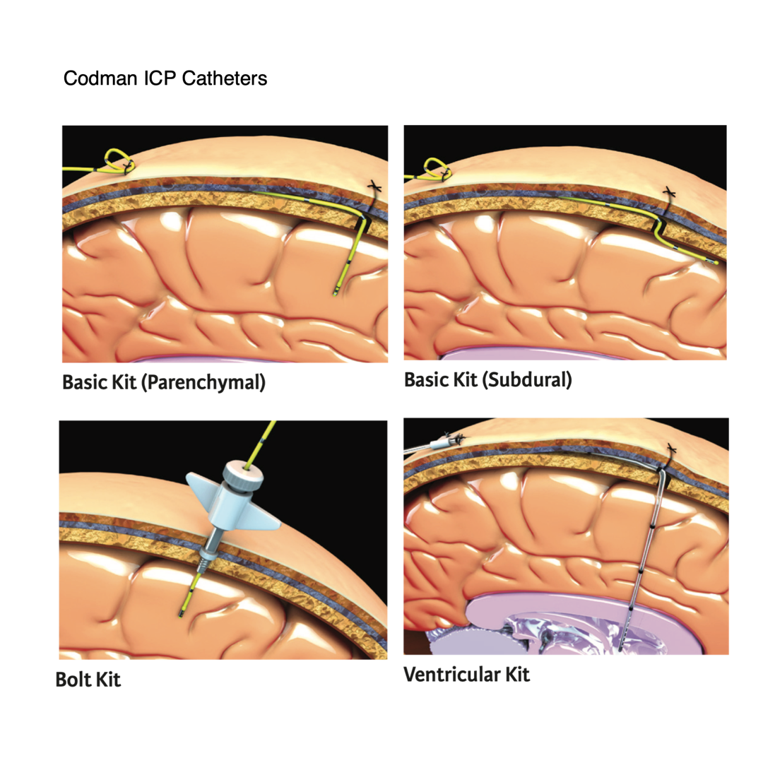 Codman ICP Catheters