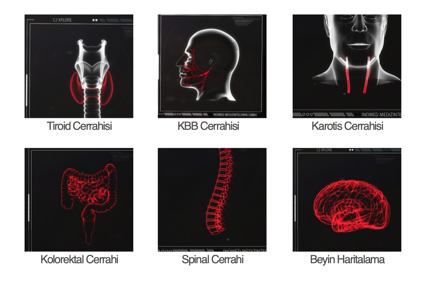 Inomed C2 Xplore Sinir Monitörü