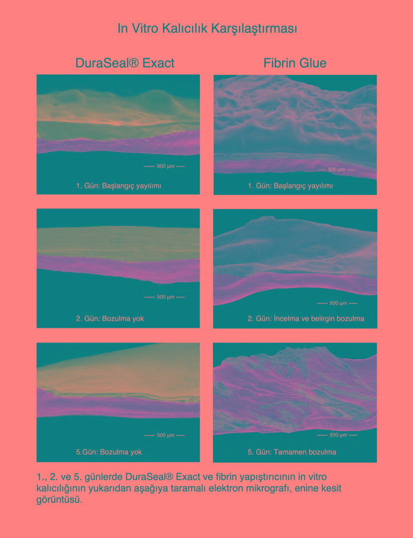 DuraSeal Xact Spinal Dura Yapıştırıcı