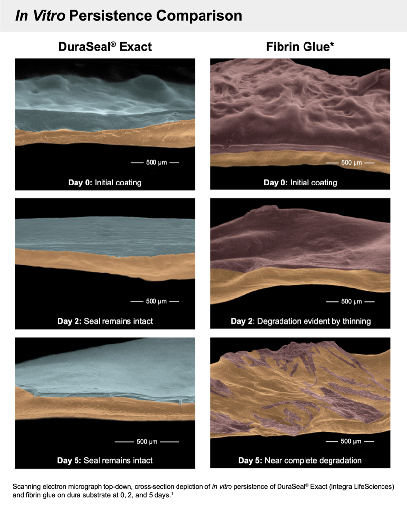 DuraSeal Xact Spinal Sealant System