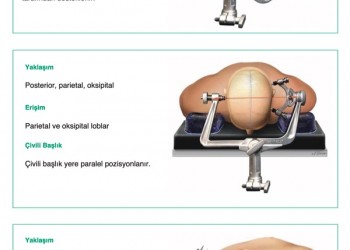 ***Başlık Pozisyonlama