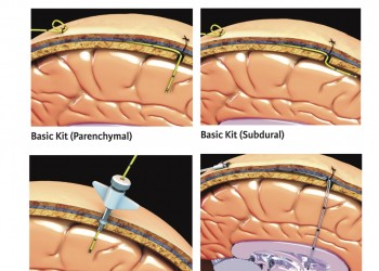 Codman ICP Kateterleri