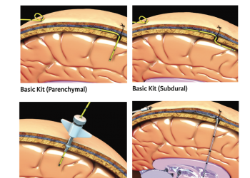 Codman ICP Catheters