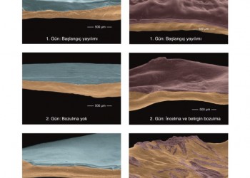DuraSeal Xact Spinal Dura Yapıştırıcı
