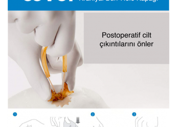 Neos Kafatası Fiksasyon